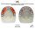 Duplo Ferrures Composite avec Pinçons et sole fermée // Paire Standard (orange) - RONDE-134 mm / 5.28 inch-Prix de paire (Deux Duplos)